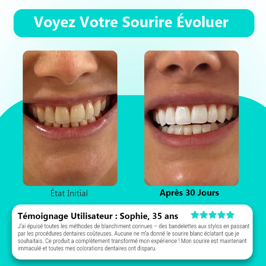 lumismile  – Brosse à dents sonique